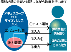 アキュスコープ微弱電流治療 - 痛みの治療 小野整骨院（川口市安行・戸塚安行） - むち打ち等の交通事故治療